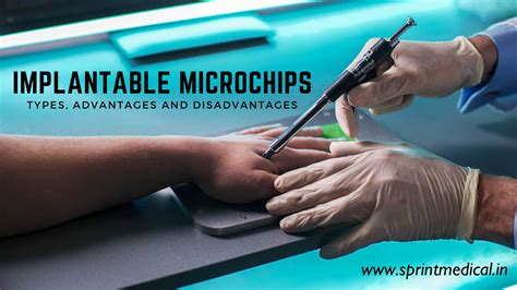 rfid chip surgery|rfid microchip implant.